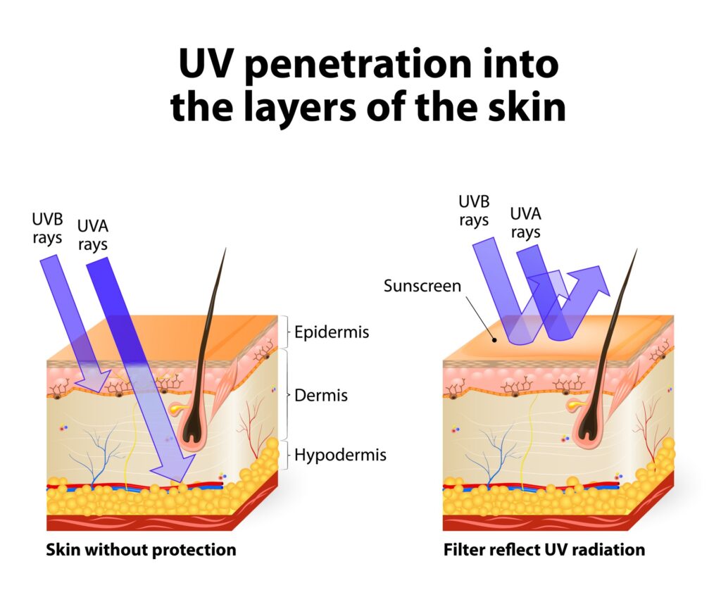 UV ray diagram for cosmetic suncreen necessity
